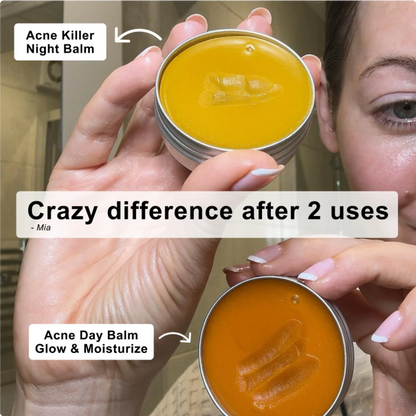 Norse Organics Redness & Breakout Support Ritual