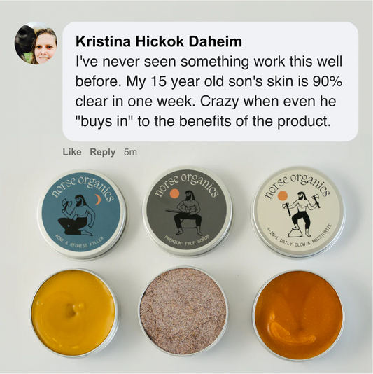 Norse Organics Redness & Breakout Support Ritual