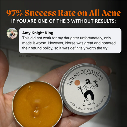 Norse Organics Redness & Breakout Support Ritual